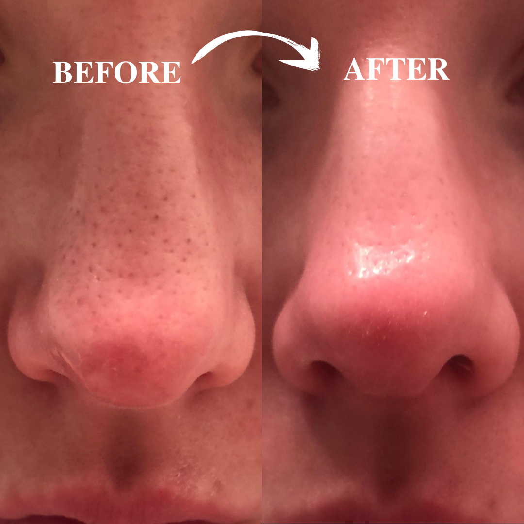 Peel Shot Instant Exfoliation Serum