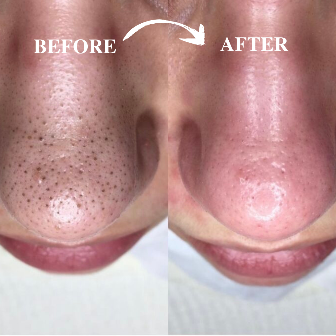Peel Shot Instant Exfoliation Serum