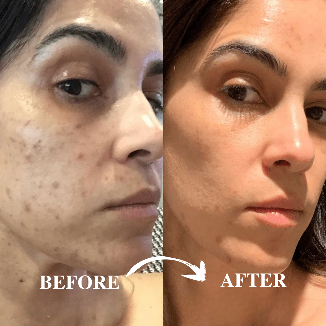 Peel Shot Instant Exfoliation Serum