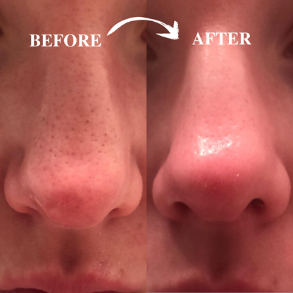 Peel Shot Instant Exfoliation Serum